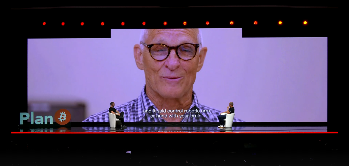 🔴 >> Un hombre compró bitcoins utilizando chips implantados en su cerebro 